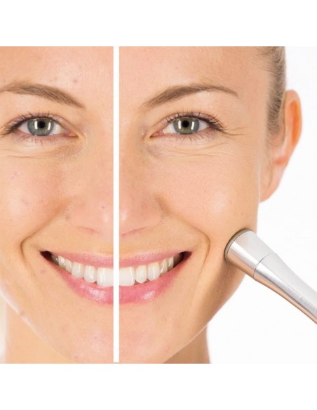 Beurer FC 100 Pureo Derma Peel Beurer FC 100 Pureo Derma Peel