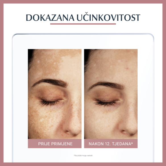 Eucerin Anti-Pigment dvofazni tretman 66883 Eucerin Anti-Pigment dvofazni tretman 66883