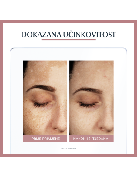 Eucerin Anti-Pigment dvofazni tretman 66883 Eucerin Anti-Pigment dvofazni tretman 66883