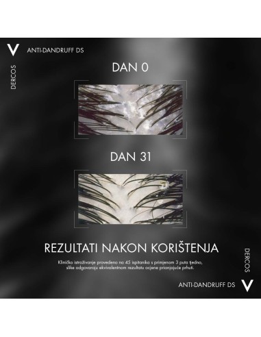 Vichy Dercos Šampon protiv prhuti za normalnu/masnu kosu 200 ml