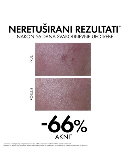 Vichy Capital Soleil UV-Clear Fluid za zaštitu od sunca protiv nepravilnosti SPF50+