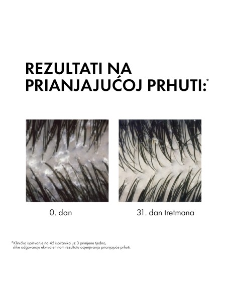 Vichy Dercos Šampon protiv prhuti za suhu kosu