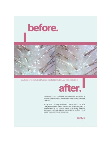 Skinlick Root Cause Sebum Balance Shampoo