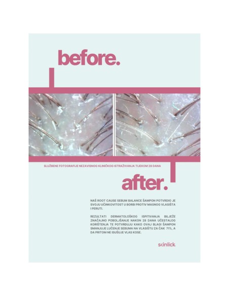 Skinlick Root Cause Sebum Balance Shampoo