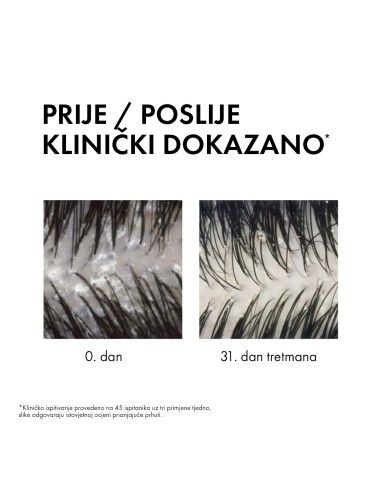 Vichy Dercos Šampon protiv prhuti DS... Vichy Dercos Šampon protiv prhuti DS...