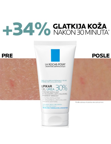 La Roche-Posay Lipikar gel s 30% ureje za ciljanu primjenu na suha i gruba područja kože La Roche-Posay Lipikar gel s 30% ureje za ciljanu primjenu na suha i gruba područja kože