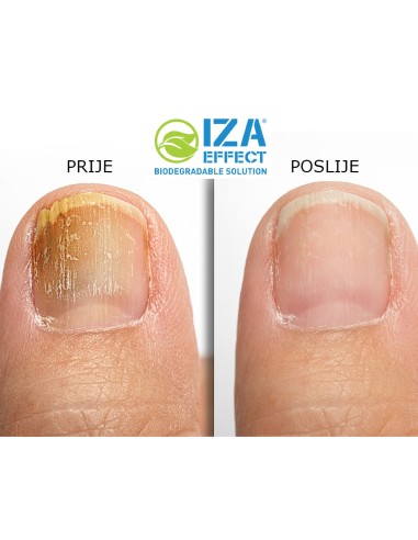 Iza Effect Sprej protiv gljivica na noktima i stopalima