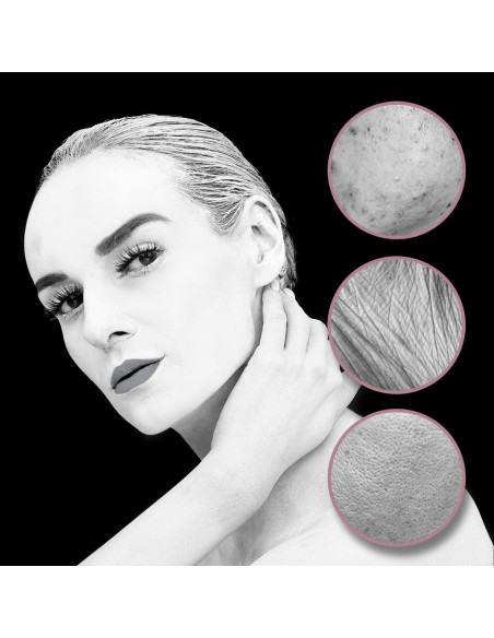 Vitammy Milda višenamjenski uređaj za njegu lica