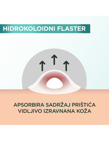 Garnier Pure Active flaster za prištiće Garnier Pure Active flaster za prištiće