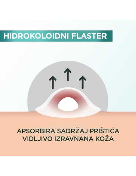 Garnier Pure Active flaster za prištiće Garnier Pure Active flaster za prištiće