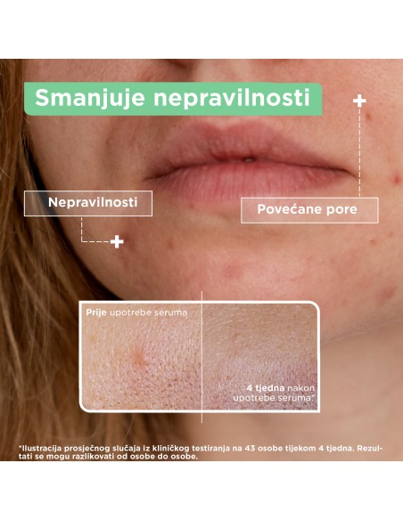 Mixa Anti- Dryness hidratantni serum protiv suhoće 30ml