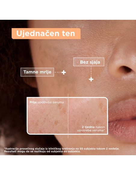 Mixa Anti - Dark Spot serum protiv tamnih mrlja 30 ml