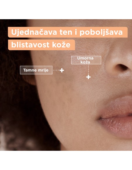 Mixa fluid protiv tamnih mrlja 50 ml