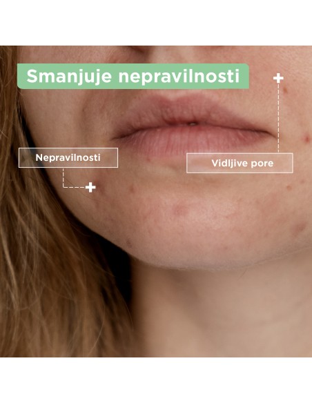 Mixa gel za čišćenje lica protiv nepravilnosti 150 ml