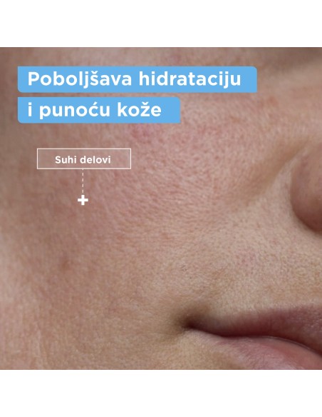 Mixa gel za čišćenje lica protiv suhoće kože 150 ml