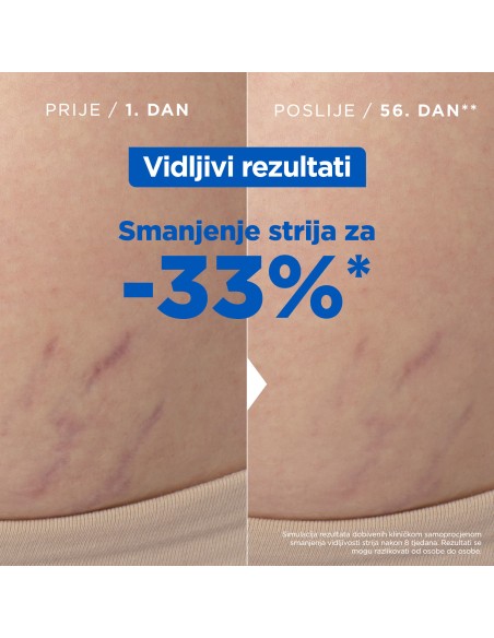Mixa Ulje protiv strija 50ml