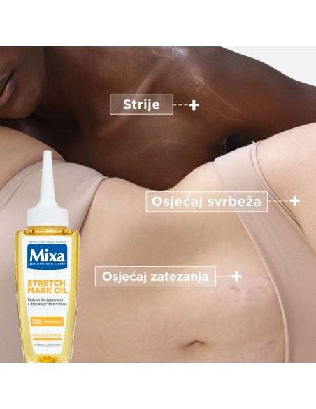 Mixa Ulje protiv strija 100ml​