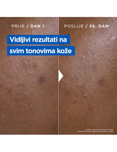 Mixa Niacinamid hidratantna krema protiv tamnih mrlja 400ml