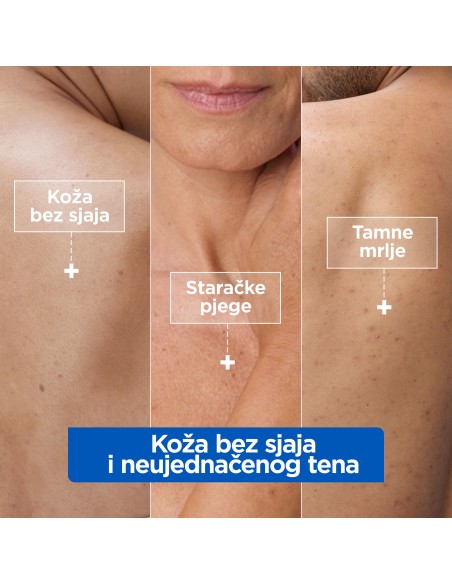 Mixa Niacinamid hidratantna krema protiv tamnih mrlja 400ml