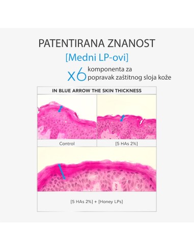 Apivita Serum s hijaluronskom kiselinom Apivita Serum s hijaluronskom kiselinom