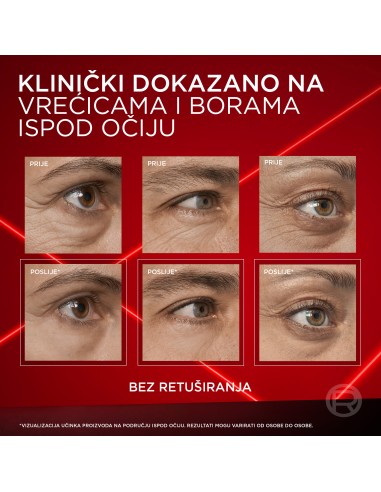 L'Oreal Paris Revitalift Laser krema... L'Oreal Paris Revitalift Laser krema...