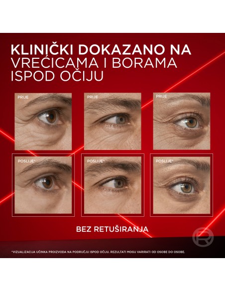 L'Oreal Paris Revitalift Laser krema za korekciju područja oko očiju 15ml POKLON uz Revitalif Laser iznad 40€