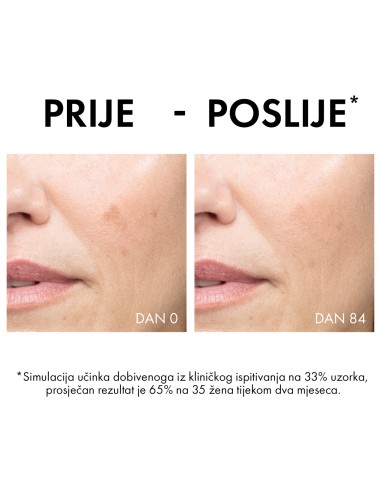 Vichy Liftactiv B3 Anti-Dark spots krema protiv hiperpigmentacijskih mrlja i bora SPF 50 Vichy Liftactiv B3 Anti-Dark spots krema protiv hiperpigmentacijskih mrlja i bora SPF 50