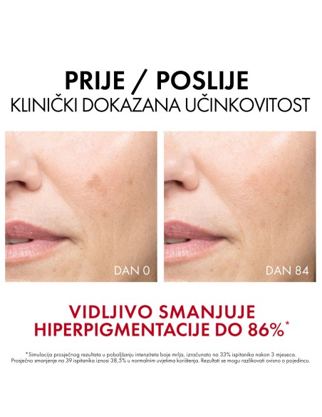 Vichy Liftactiv Specialist B3 Dark Spots Serum protiv bora i tamnih hiperpigmentacijskih mrlja Vichy Liftactiv Specialist B3 Dark Spots Serum protiv bora i tamnih hiperpigmentacijskih mrlja