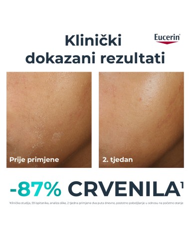 Eucerin DermoPure Clinical dopunska umirujuća krema 99308