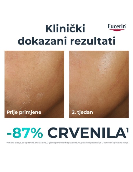 Eucerin DermoPure Clinical dopunska umirujuća krema 99308