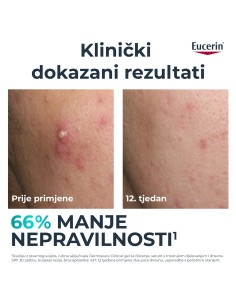 Eucerin DermoPure Clinical serum s trostrukim djelovanjem 66862 2