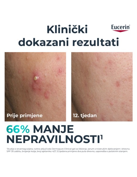 Eucerin DermoPure Clinical serum s trostrukim djelovanjem 66862