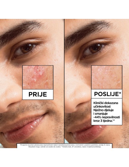 Garnier Pure Active Salicylic serum