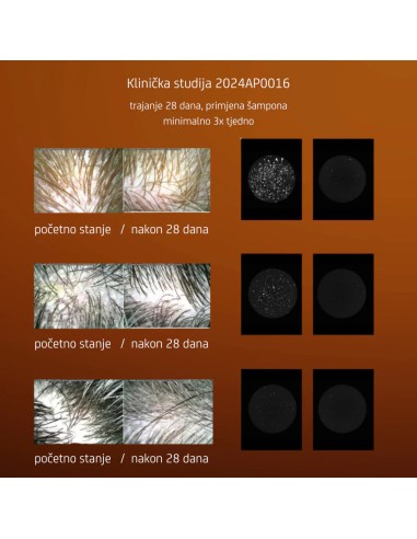 Nuggela & Sule Anti-Dandruff Šampon protiv prhuti