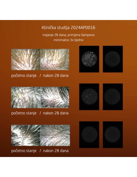 Nuggela & Sule Anti-Dandruff Šampon protiv prhuti