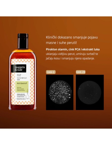 Nuggela & Sule Anti-Dandruff Šampon protiv prhuti
