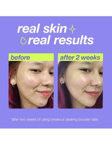 Dermalogica Breakout Clearing Booster