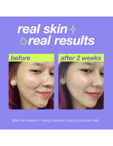 Dermalogica Breakout Clearing Booster
