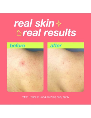 Dermalogica Clarifying Body Spray
