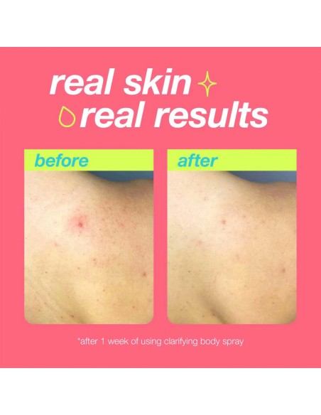 Dermalogica Clarifying Body Spray
