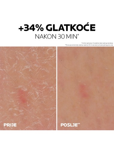 La Roche-Posay Lipikar gel s 30% ureje za ciljanu primjenu na suha i gruba područja kože