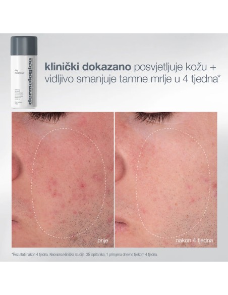 Dermalogica Blagdanski paketi 2026 expert cleanse and glow Promo pakiranje