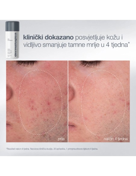 Dermalogica Blagdanski paketi 2026 glow on the go Promo pakiranje