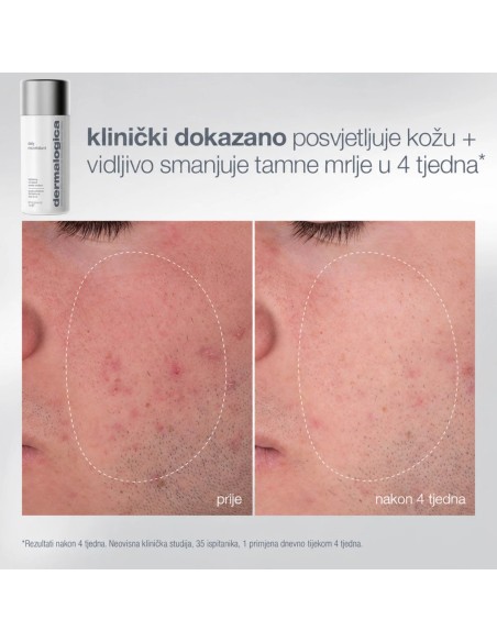 Dermalogica Blagdanski paketi 2026 pro ritual: exfoliate and glow Promo pakiranje
