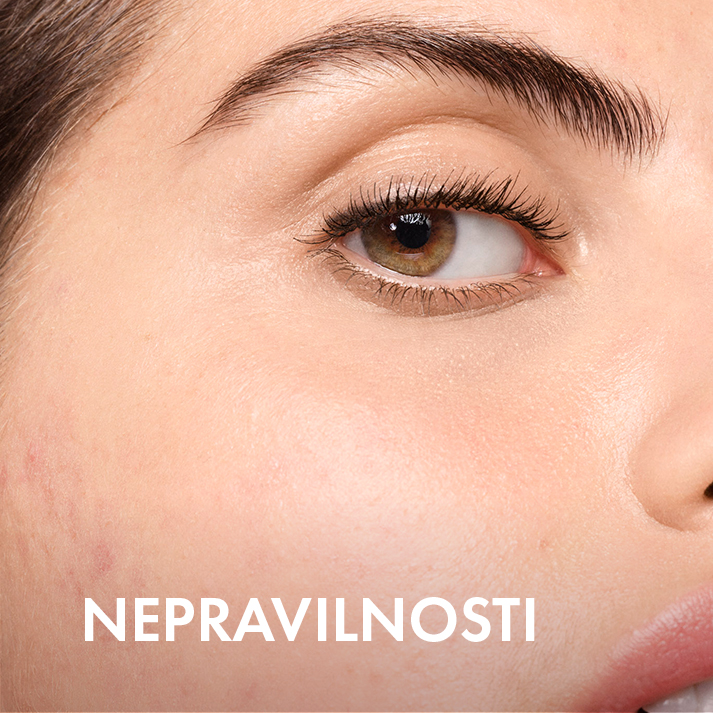 Nepravilnosti